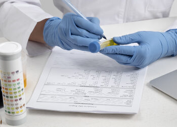 Intelligenza Artificiale per perfezionare l’interpretazione dei Drug Test